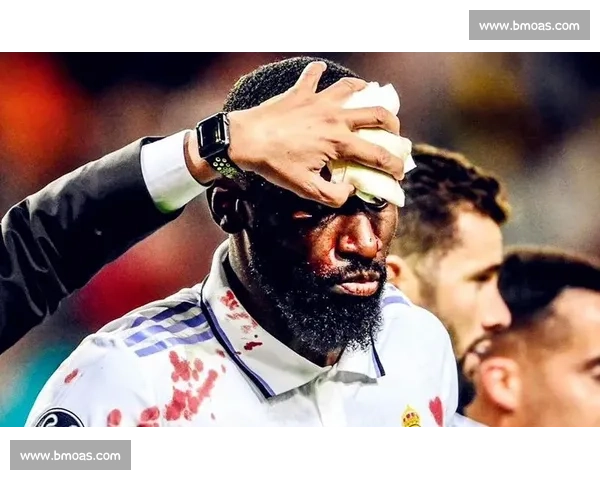 铁血真汉子！XX选手硬汉对决，血染赛场，诠释拳击精神！